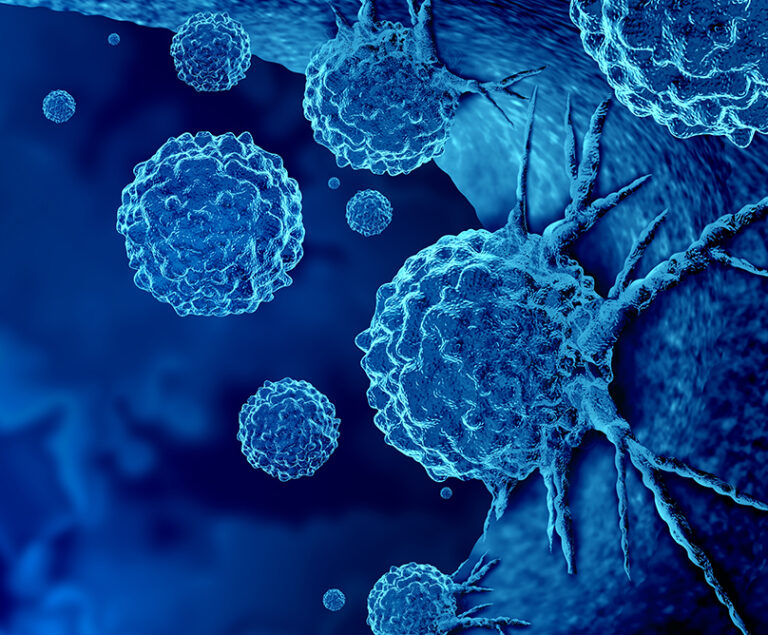 14 συστάσεις για την πρόληψη του καρκίνου από τον καθηγητή Θεραπευτικής Αιματολογίας-Ογκολογίας Θ. Δημόπουλο