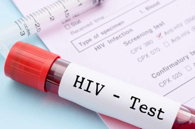 Ευρωπαϊκή Εβδομάδα Εξέτασης για τον HIV και τις Ηπατίτιδες - Δωρεάν εξετάσεις