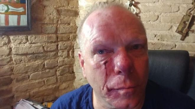 Δολοφονική επίθεση σε δημοσιογράφο - Είχε κάνει ντοκιμαντέρ για τη Χρυσή Αυγή [ΗΧΗΤΙΚΟ ΝΤΟΚΟΥΜΕΝΤΟ]