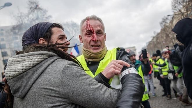 «Κίτρινα γιλέκα»: Επεισόδια στο Παρίσι, ένας διαδηλωτής τραυματίστηκε σοβαρά