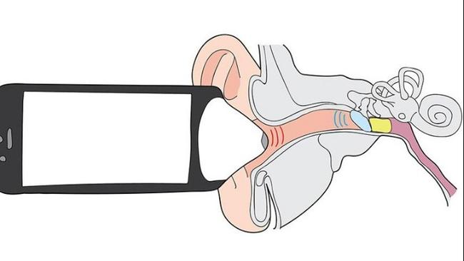Η πρώτη εφαρμογή κινητού που μπορεί να «ακούσει» τις ωτίτιδες χωρίς καν διάγνωση από γιατρό