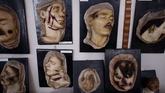 Ένα Μουσείο για "σκληρά" στομάχια... Περιήγηση στο Εγκληματολογικό Μουσείο της Ιατρικής Σχολής Αθηνών (video)