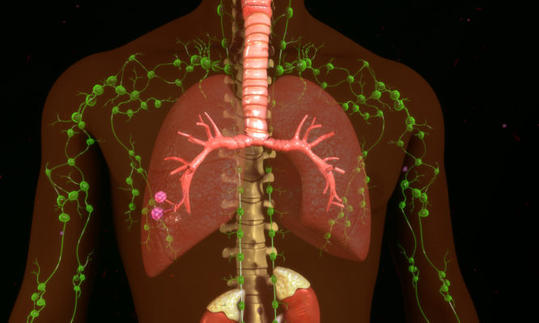 img113243_3b3961c11823f5602398e62c7273f81a