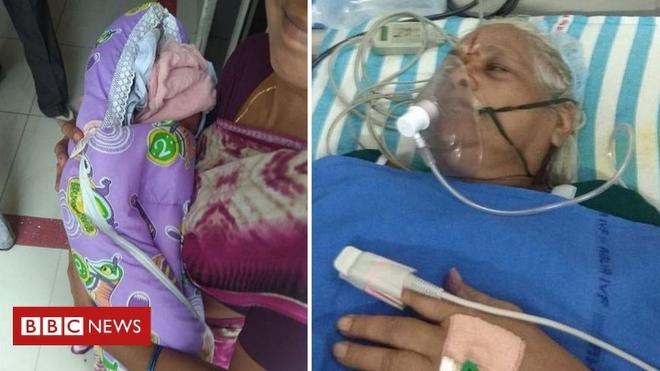73χρονη γέννησε δίδυμα κοριτσάκια και την επομένη ο 82χρονος σύζυγός της υπέστη εγκεφαλικό