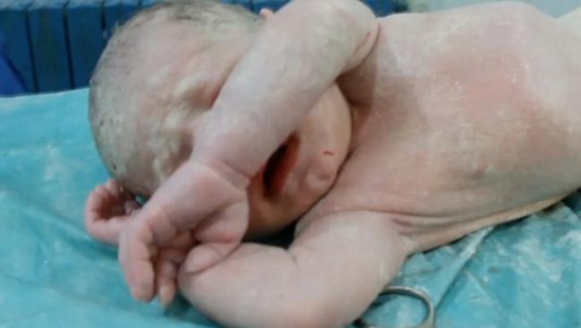 Συρία: Η Mayissa πήγαινε στο νοσοκομείο να γεννήσει όταν χτυπήθηκε από βόμβα (ΒΙΝΤΕΟ)