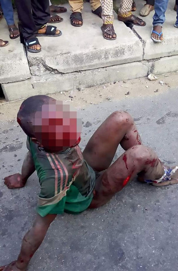 Νιγηρία: Έκαψαν ζωντανό αγόρι επειδή έκλεψε τρόφιμα [ΦΩΤΟ]