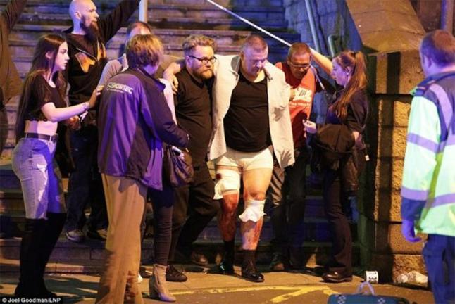 Καμικάζι σκορπά το θάνατο σε συναυλία στο Μάντσεστερ: 19 νεκροί, 50 τραυματίες [ΒΙΝΤΕΟ]
