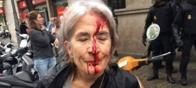 Καταλονία: Βίαιη επέμβαση της αστυνομίας - αιματηρά επεισόδια με 38 τραυματίες [ΦΩΤΟ - ΒΙΝΤΕΟ]