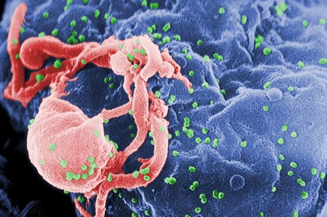 Φάρμακο για τον καρκίνο ‘τρέπει σε φυγή’ τον ιό HIV