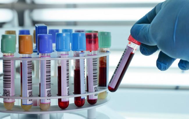 Εξέταση αίματος ανιχνεύει οκτώ διαφορετικούς τύπους καρκίνου