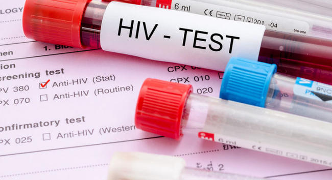 Δωρεάν εξέταση για HIV στο Δημοτικό Ιατρείο της Κυψέλης