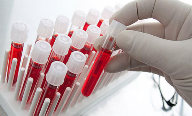 Πως συνδέεται η ομάδα αίματος με τον κίνδυνο θανάτου από αιμορραγία