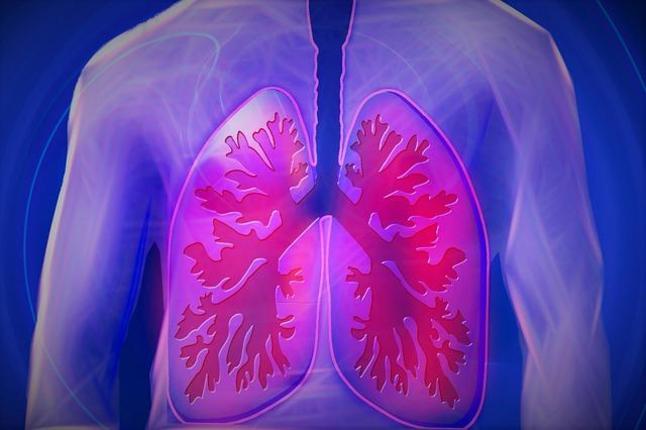 Επανάσταση στην αντιμετώπιση του καρκίνου του πνεύμονα - Ανοσοθεραπεία με νεότερα φάρμακα