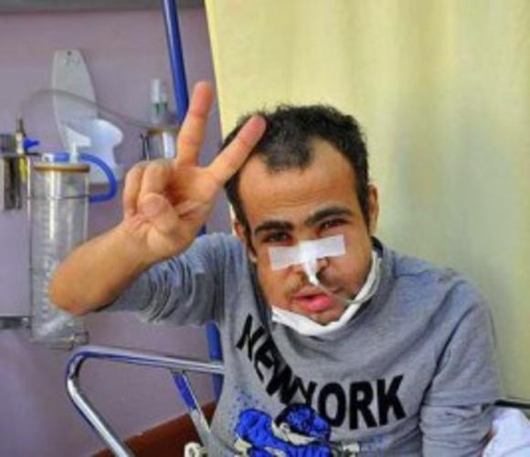 Τουρκία: πέθανε ο Μεχμέτ Ιστίφ από θανάσιμο ψέκασμα στο πρόσωπο