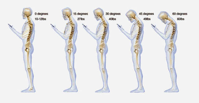Πώς η τεχνολογία εμποδίζει την σωστή στάση του σώματος [εικόνα-βίντεο]