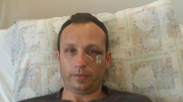 Χανιά: Το βίντεο της πισώπλατης δολοφονικής επίθεσης στον γιατρό Δημήτρη Μακρέα από φασίστες