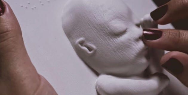 Τυφλή έγκυος "βλέπει" για πρώτη φορά το αγέννητο μωρό της με 3D εκτύπωση! (φωτο-βίντεο)