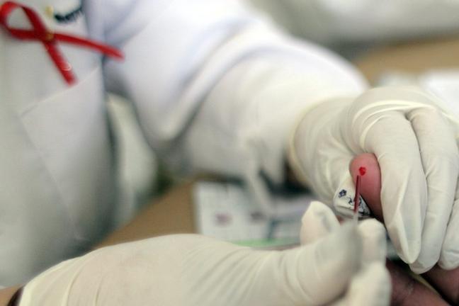 Καλά νέα: Επιστήμονες βρήκαν "αχίλλειο πτέρνα" στον ιό HIV του AIDS
